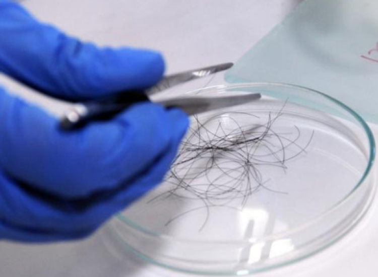 Detectan deficiencias en la dieta a través del análisis de las proteínas del pelo